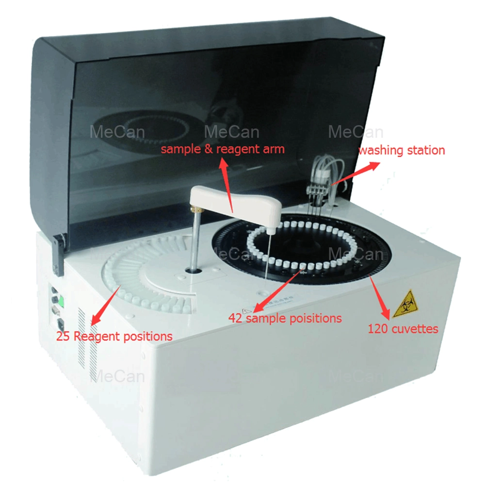 Full Automated Human Blood Biochemistry Bio Auto Chemistry Analyzer