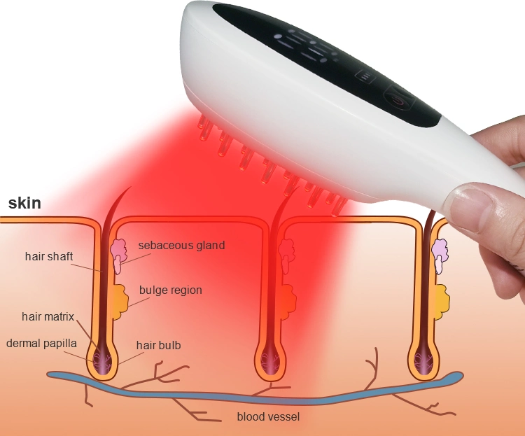 Equipement de beauté pour cheveux puissance lumineuse LED stimuler la croissance des cheveux