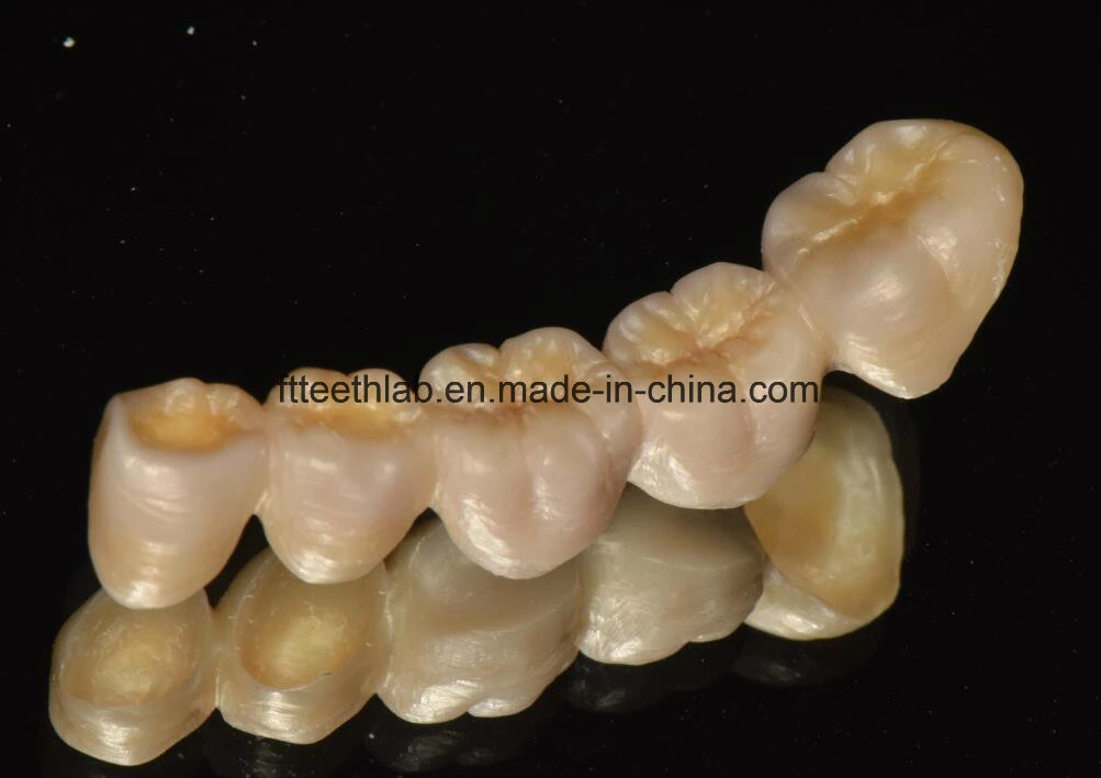 Full Contour Zirconium Bridge Made in China Dental Lab