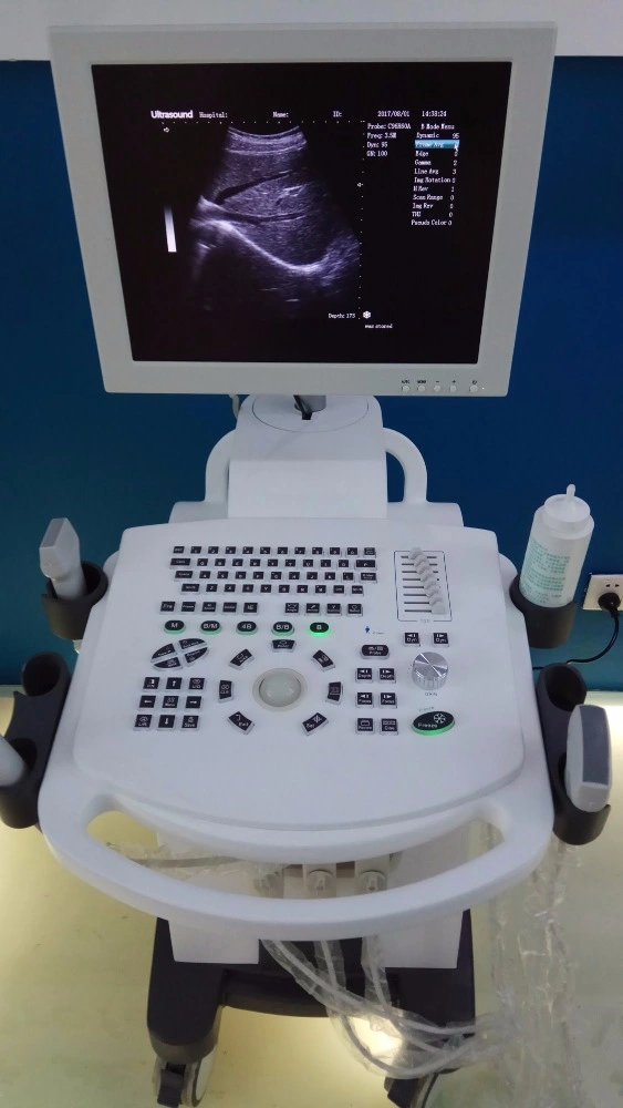 Hospital Equipment B/W Trolley Ultrasound Scanning Machine for Human (THR-US370)