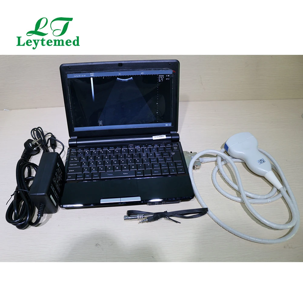 Ltub25 Laptop Portable Full Digital Medical Pregnancy Scanner Ultrasound Echography Equipment