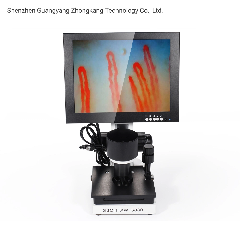 Portable 10 Inch Noninvasive Blood Capillary Microcirculation Microscope