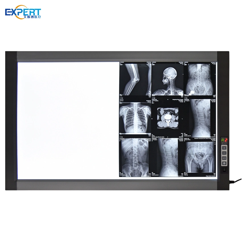 Medical Double Union Hospital Xray Single View Dental X Ray Film Scanner Box