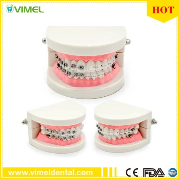 Modelo de dientes Dental Ortodoncia con el soporte del modelo de enseñanza para estudiantes