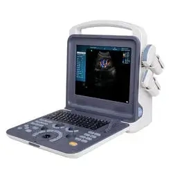 Tragbarer Laptop Doppler LCD Full Digital Color Doppler Ultraschallscanner Diagnosesystem