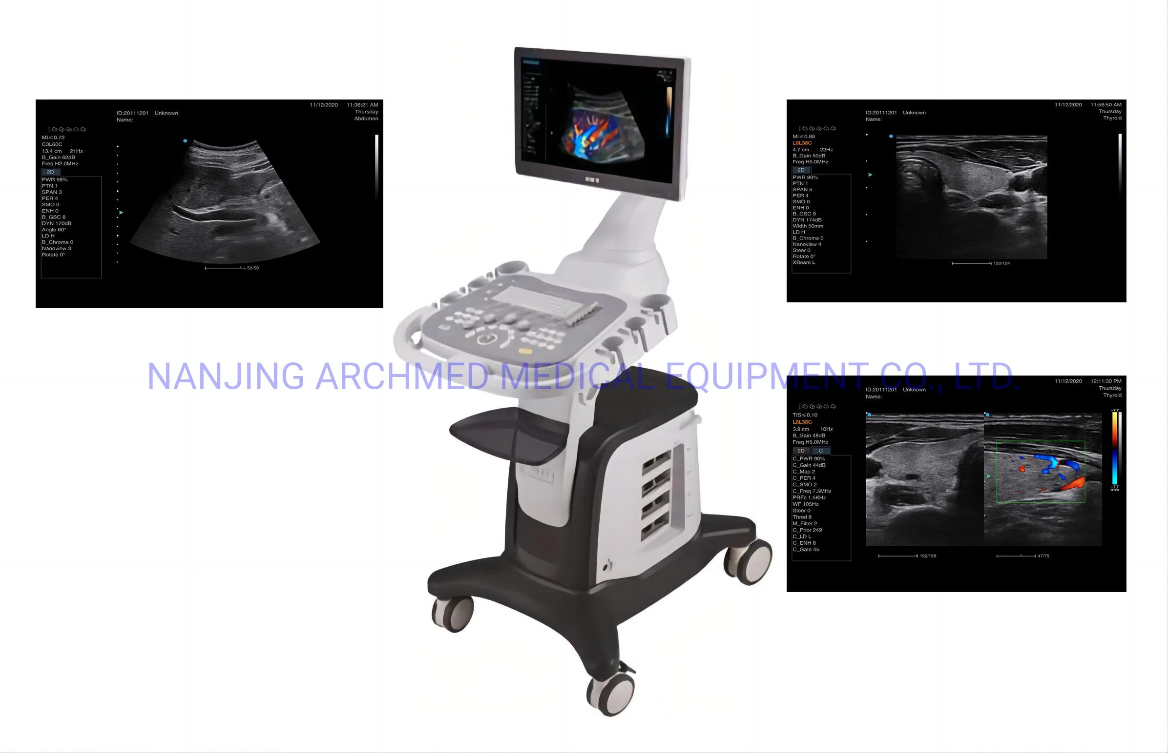 Medizinische Geräte Voll Digital Tragbare Farb-Doppler-Diagnosesystem Ultraschall Scanner-Ultraschallmaschine mit 18,5′ ′ LCD-Monitor