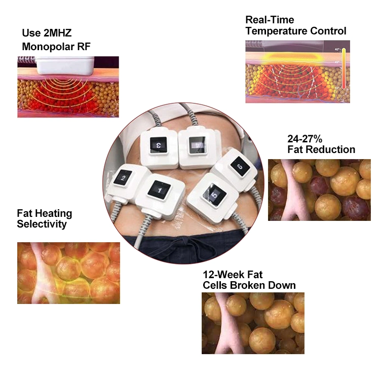 El equipo de Salón de belleza de la máquina de escultura corporal la pérdida de peso adelgazar piel RF par Body Contouring Sculpt 3D de la máquina