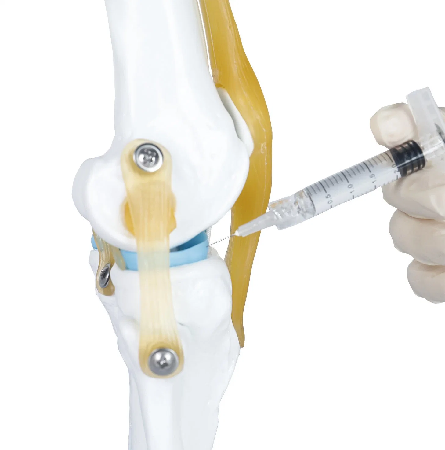 Instruments chirurgicaux orthopédiques en gel d'hyaluronate de sodium médical