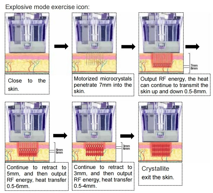 La máquina de eliminación de cicatriz Microneedling RF piel par Morpheus 8 fracciones de la máquina