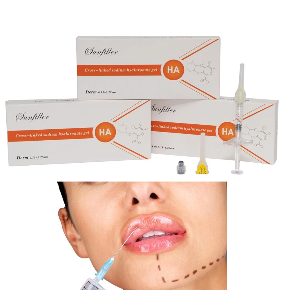 Buy Plastic Surgery Medical Sodium Hyaluronate Gel for Lip