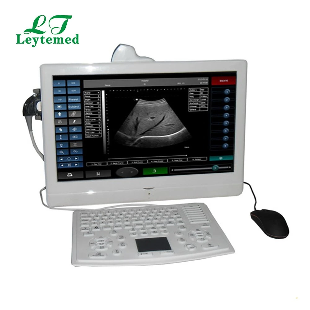 Ltub21V Portable Vet Touch Screen LCD Ultrasound Scanner for Pet Hospital