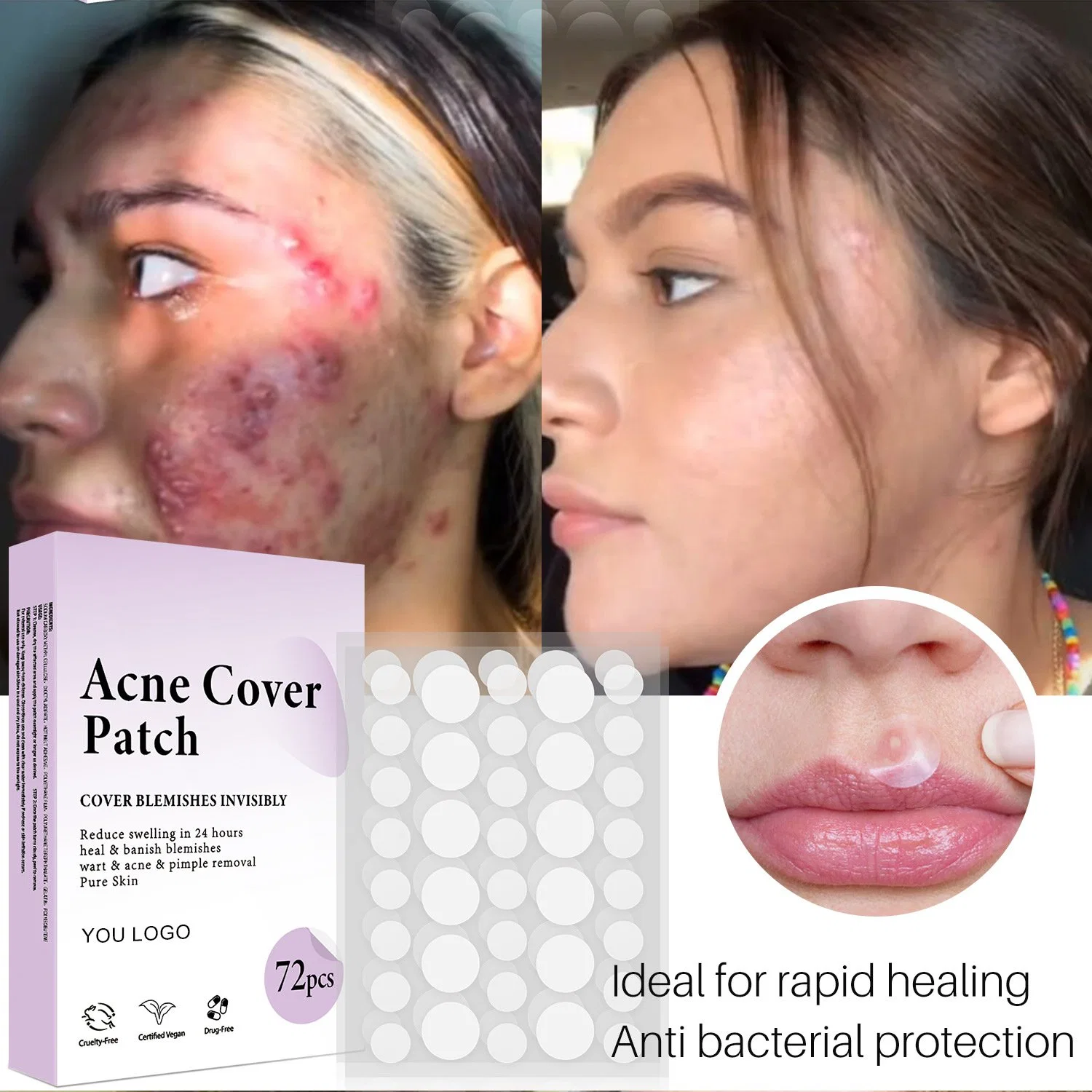 Beauty Cosmetics Skin Care Pimple Patch Blemishes Breakouts Spot Treatment Facial Stickers