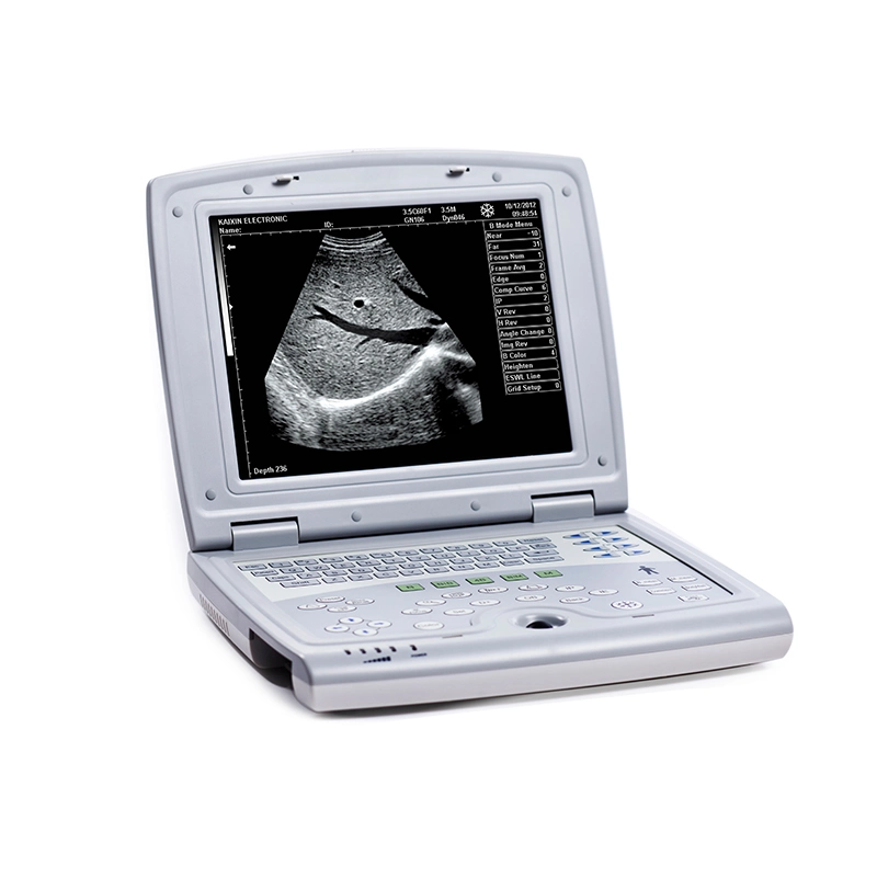 Laptop Design Veterinary Ultrasound Scanner with Ce Certificate