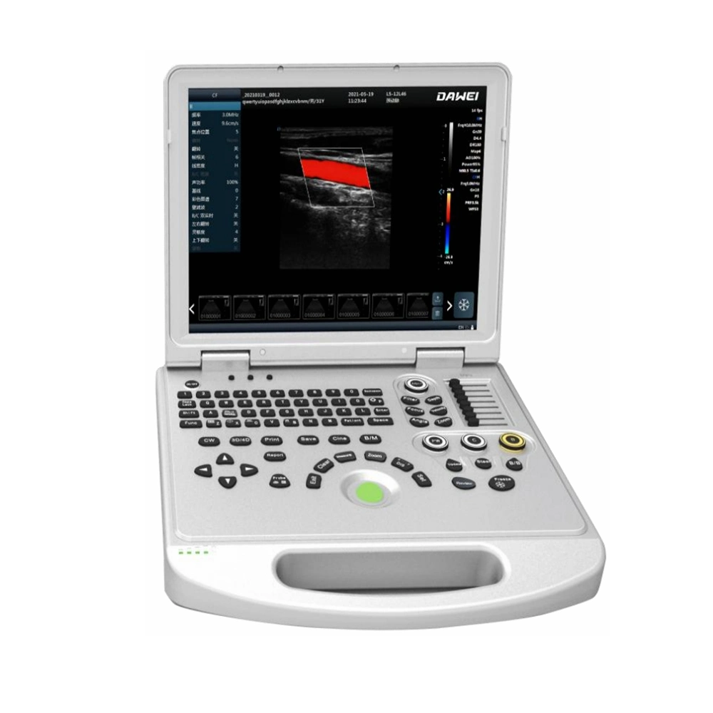 Ultrasound Scanner Portable Color Doppler 3D Portable Ultrasound Machine for Clinic and Hospital