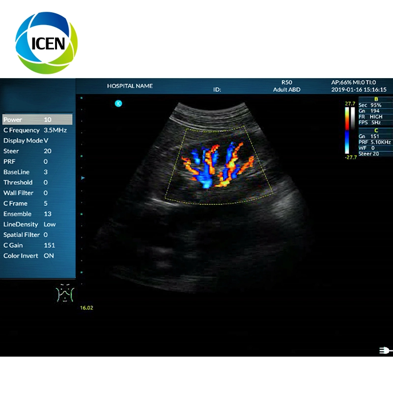 En el AK0 iPhone sonda 3D 4D ecografía Doppler Color de la máquina de cavitación