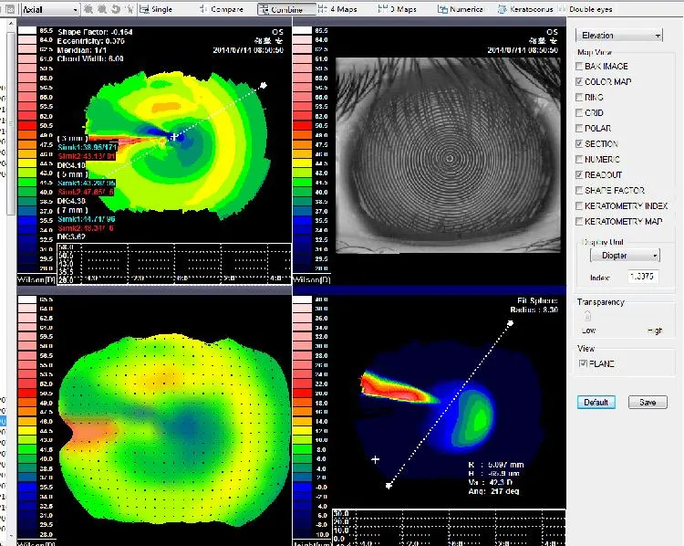 Topography Equipment Corneal Topographer