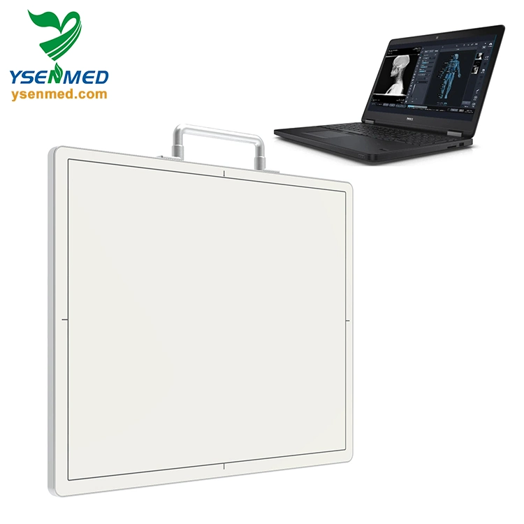 Ysfpd3543A Wireless/ Wired Digital Portable Medical 14*17 Flat Panel X Ray Detector