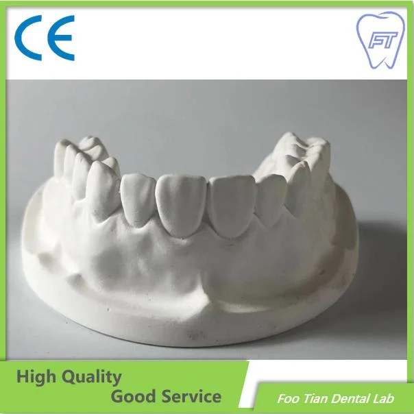 High Quality Orthodontics Study Model Removable Denture