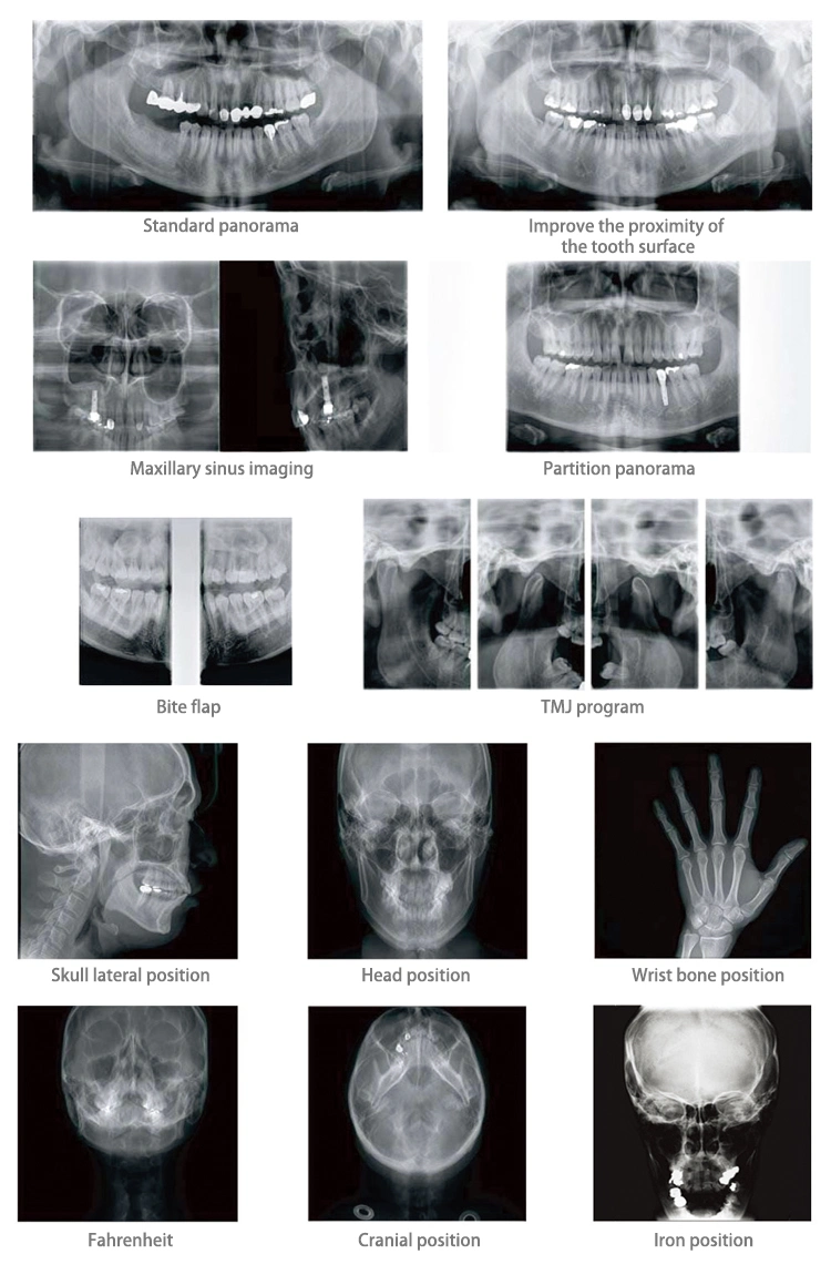 Digital Panoramic Dental X-ray Machine Other Medical Dental Equipments