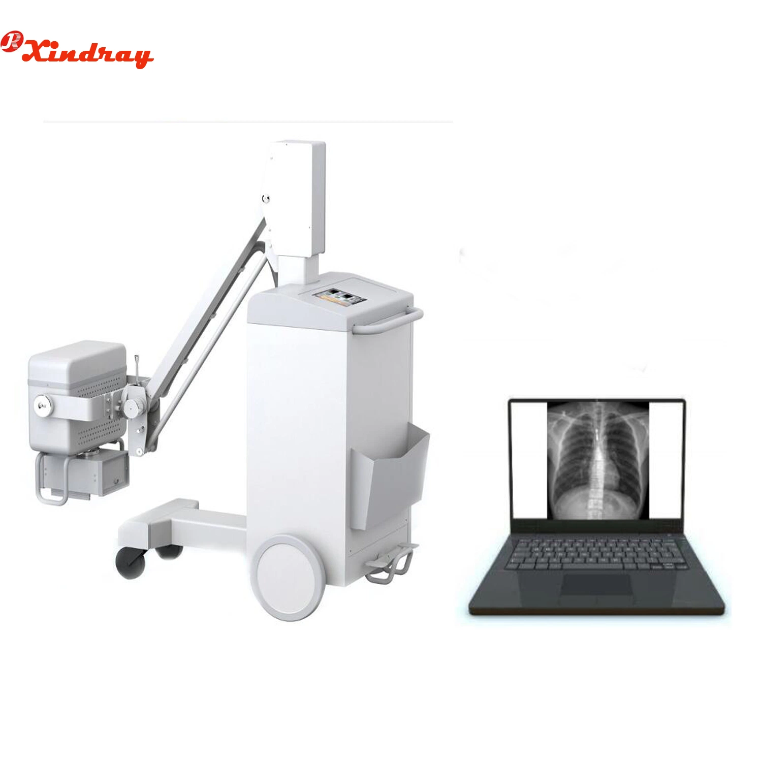 Hospital X-ray Radiography Machine Convenient Operation for Outdoor