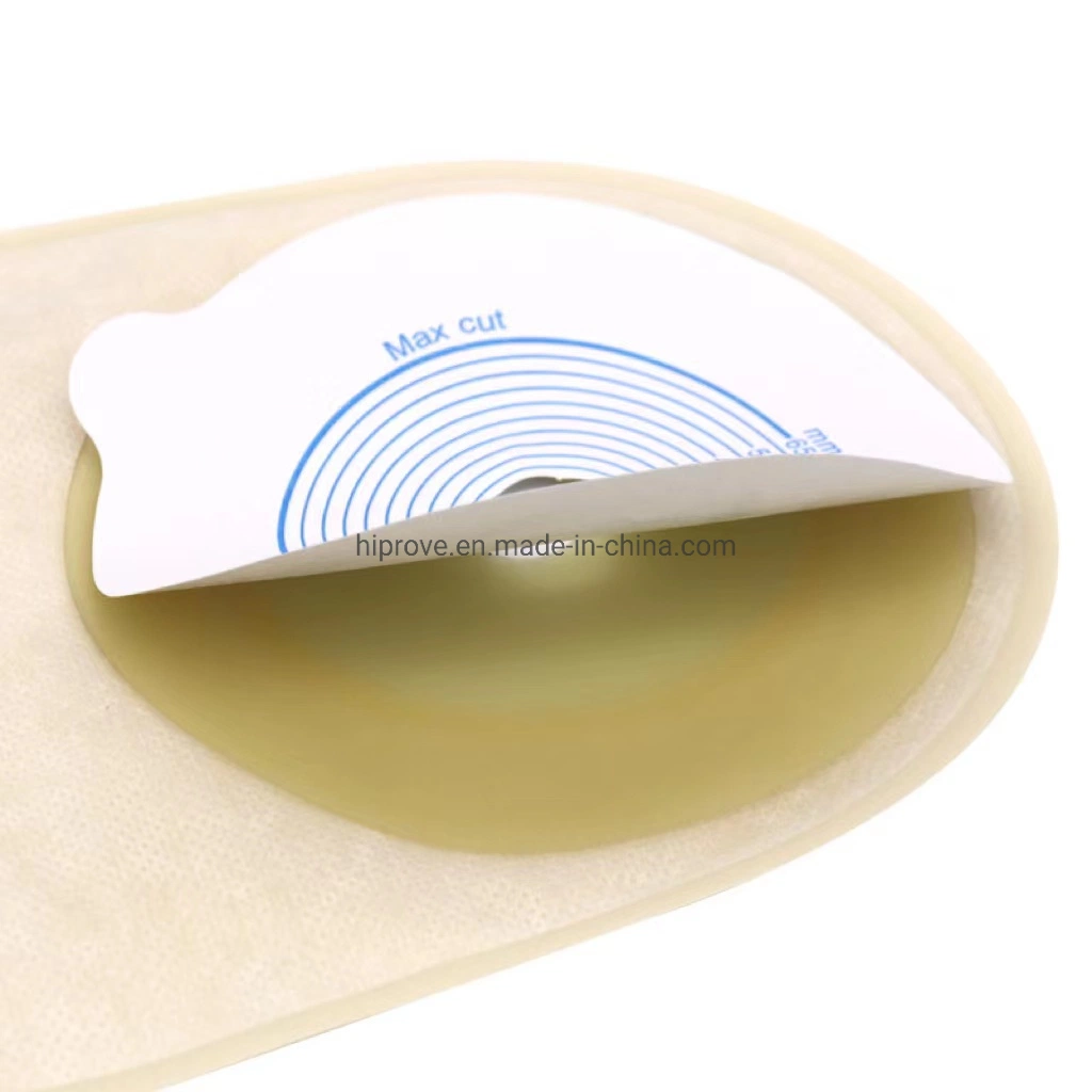 Disposable Medical Open Non Woven Hydrocolloid Barrier Pouch Piece Closed Colostomy Care Sterilized 60mm 65mm Medical Ostomy Bag with Hook and Loop Closure