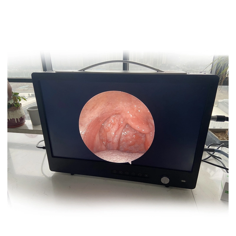 Hot Sale Full Transforaminal Equipment Cart Surgical Portable Endoscope Endoscopic Camera System