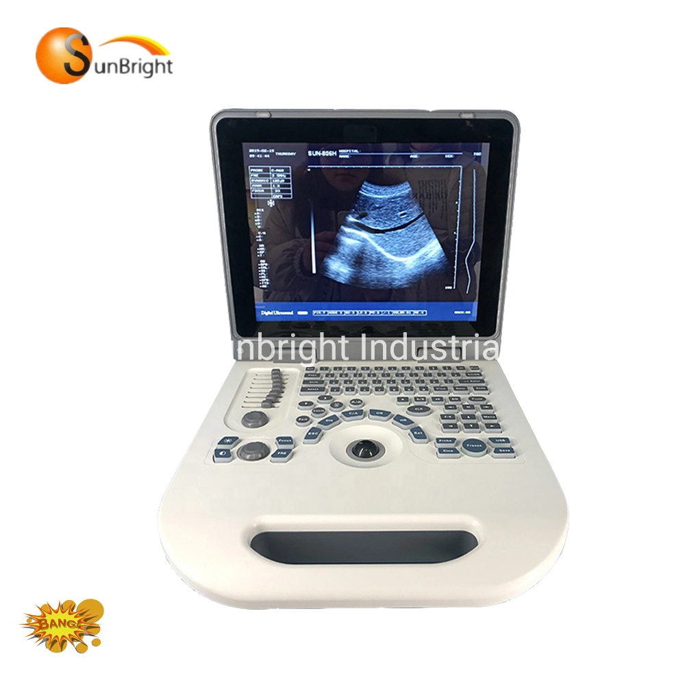 New Best Ultrasound 2 Probe Ports 2D Image Sun 806g