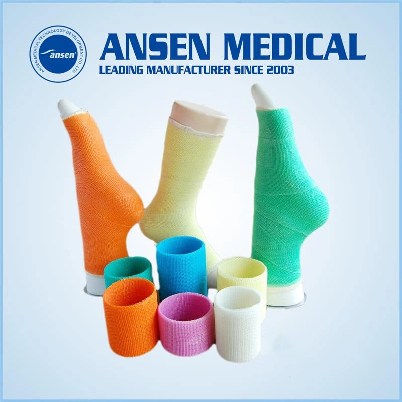 Supplier Various Sizes Orthopedic Fiberglass Casting Tape Manufacturers Casts Bandage Surgical Orthopedic Cast for Immobilization