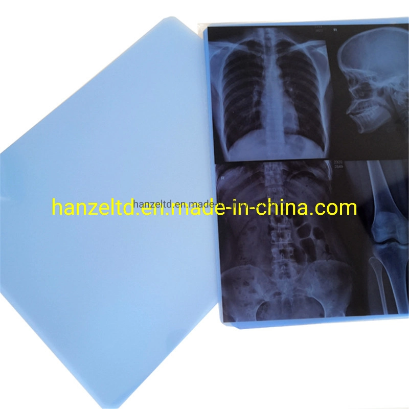 Inkjet Printing X-ray Dry Blue Medical Film