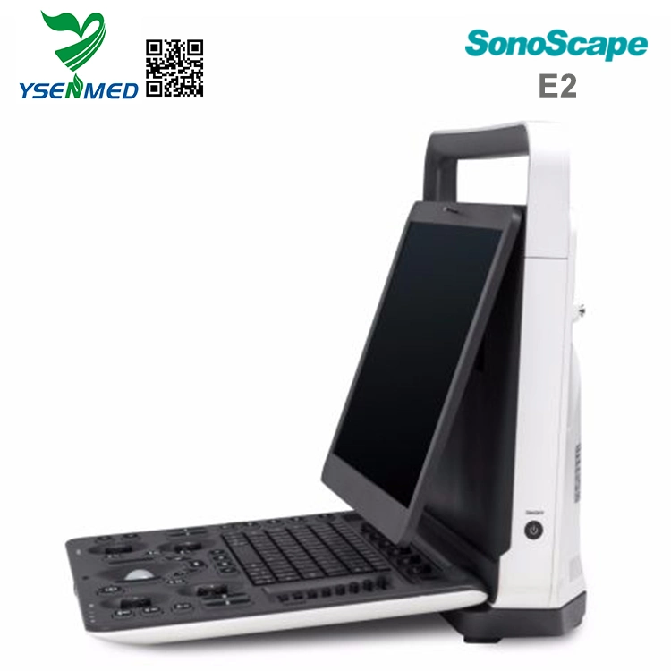 Sonoscape E2 Medizinische Geräte hochwertiger digitaler Laptop-Herzultraschall Scanner