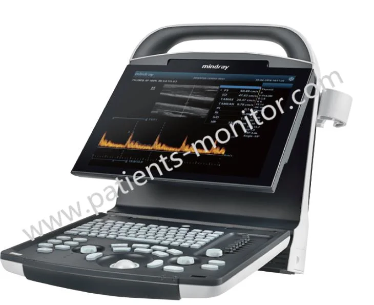 Mindray Dp10 Digital Ultrasonic Diagnostic Imaging System Used Ultrasound Medical Equipment