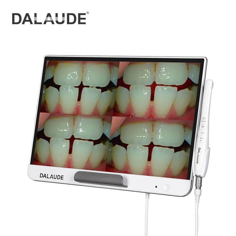 2022 Nice Monitor Intra Oral Camera Images&Video Wireless Transmission in Dentistry