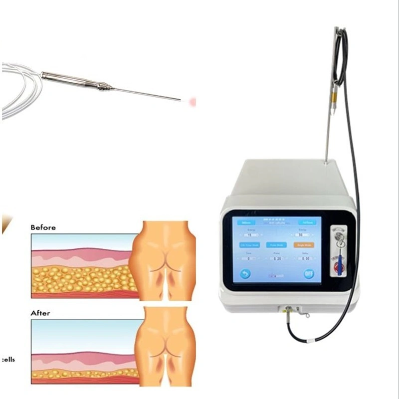Professional láser de diodo 980 Nm Portable Láser quirúrgico de la liposucción la pérdida de peso corporal de la máquina de liposucción Vaser Microfibra