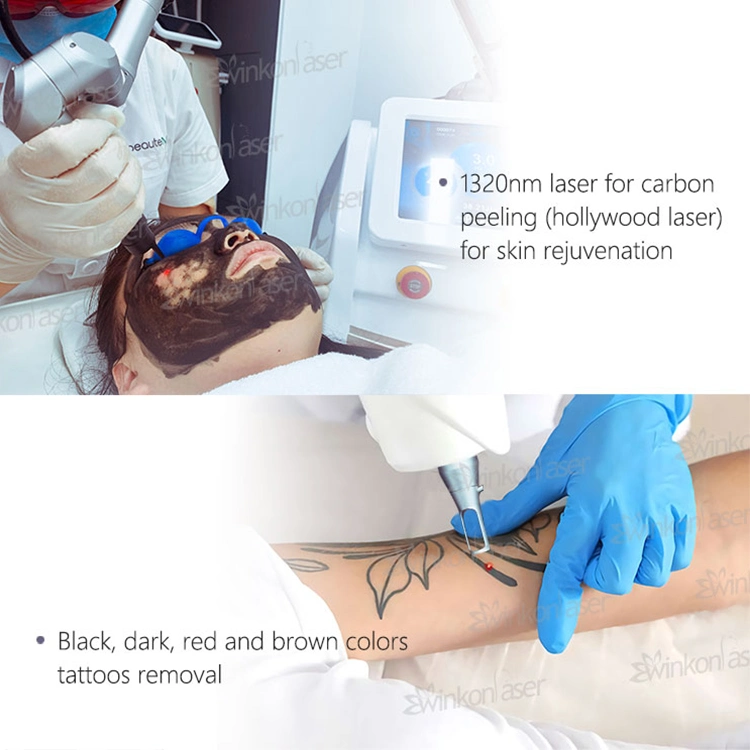 Carbon Laser Peel Whitening Face ND YAG Laser Machine for Beauty Care