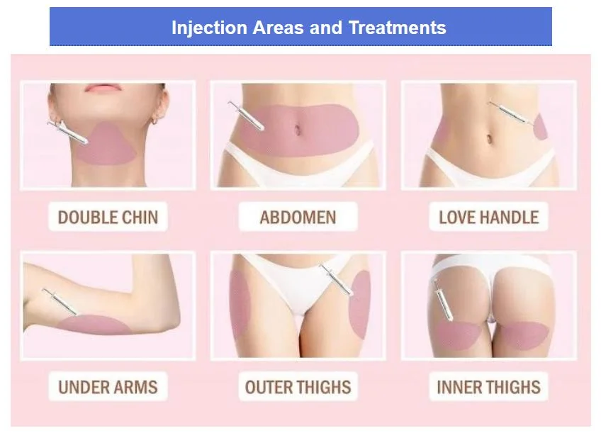 Hot Selling Safe Body Lipolysis Mesotherapy Injection Meso Lipo Serum Fat Loss Deoxycholic Acid Injection Mesotherapy Ampoules