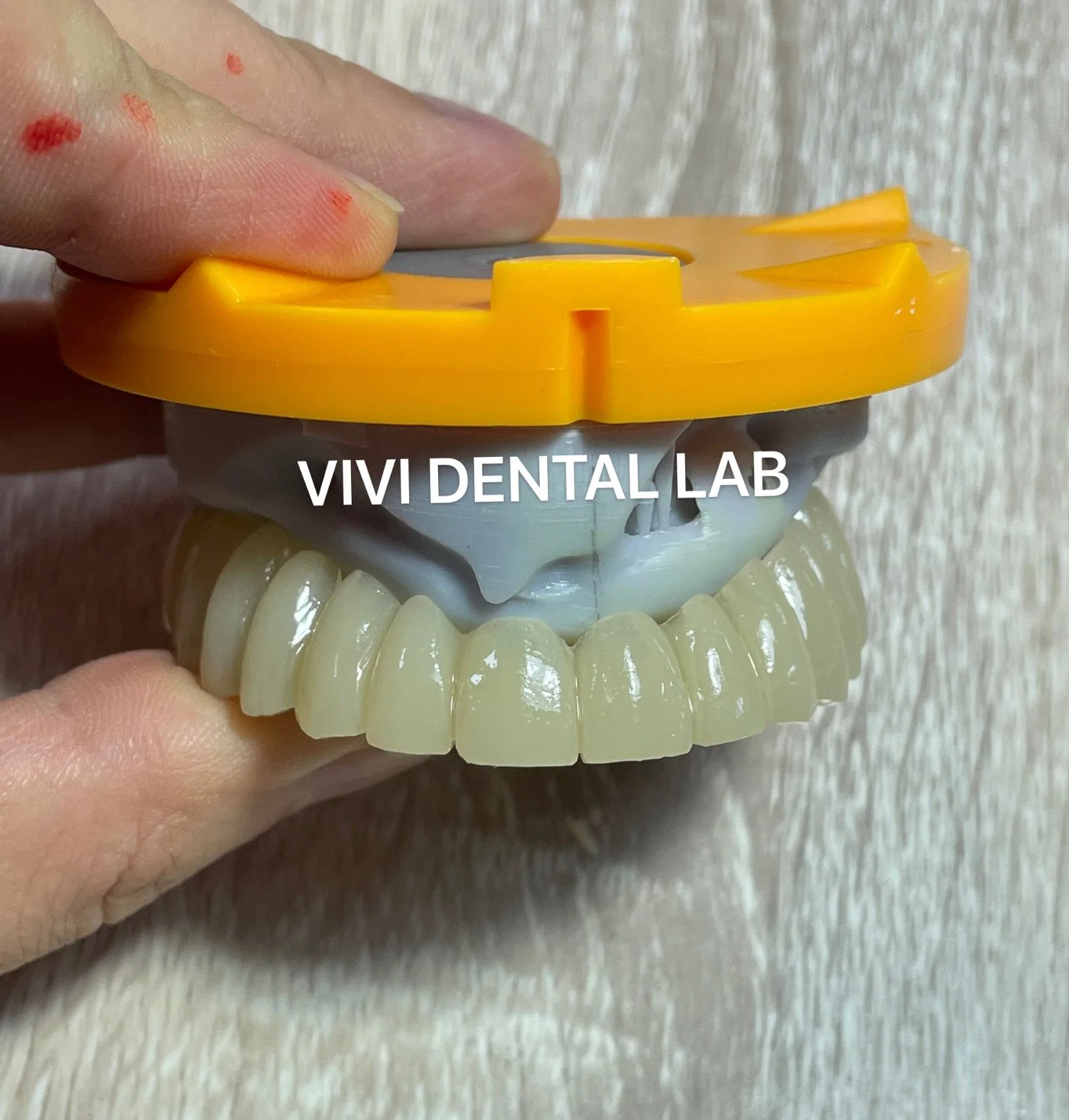 Temporary Crown - China Dental Lab Dental Crown in Good Quality and Good Esthetics