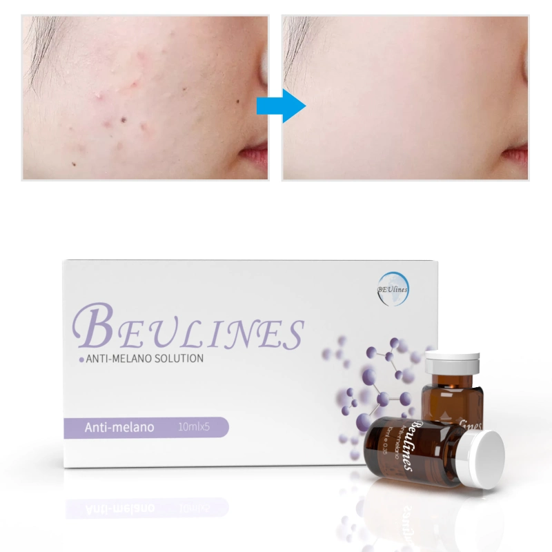 Skin Bleaching Injection Anti Pigment Hyperpigmentation Melanin Removal Anti Melano Serum Solution