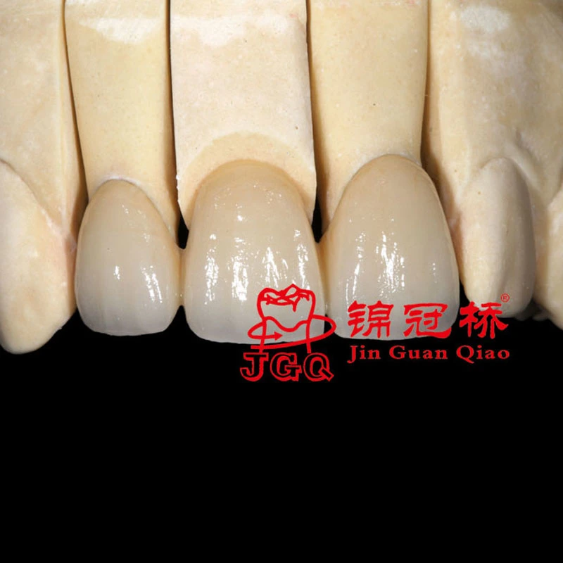 Zirconio contorno completo todos Ceramic Corona y Puentes Dental Lab En China