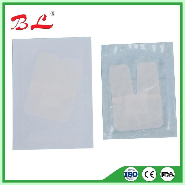 Medical Supply Factory Price Sterile Catheter Fixation Dressing for IV -F