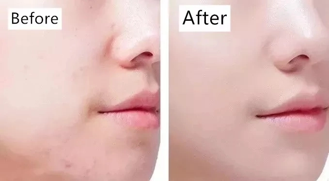 Heißer Verkauf Amazon Portable Face Lift Gesichtsmassage Schönheit Produkt Gua Sha Massagegerät Für Die Körperpflege