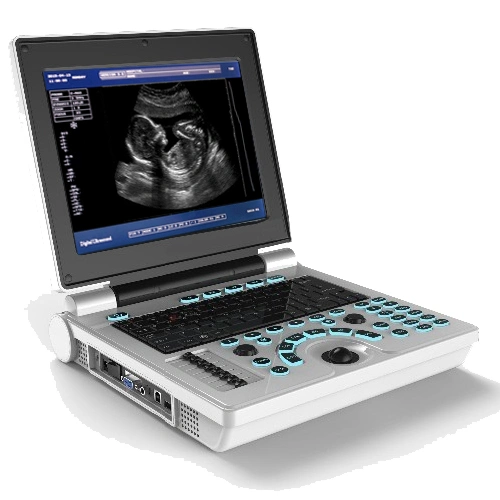 Medical Diagnosis Equipemnt B/W Portable Ultrasound Scanner Hospital Equipment