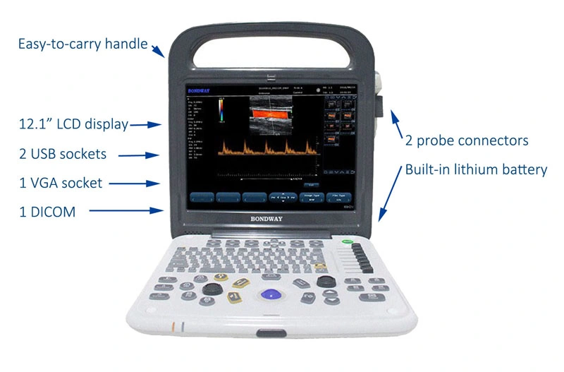 Fabrik niedriger Preis voll Digital Tragbares Farbe Doppler-Diagnostikultraschall-Bildgebungssystem, mit 12-1 Zoll hochauflösendem LCD, medizinische Ultraschallmaschine