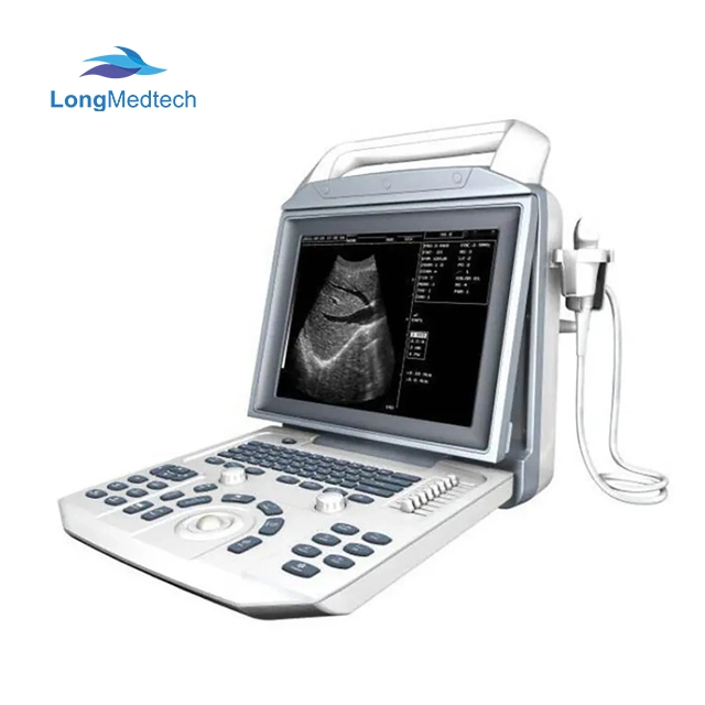 Tragbares medizinisches Farbdoppler-Ultraschallsystem Zoncare i50 System 3D 4D Farbdoppler Laptop Ultraschall