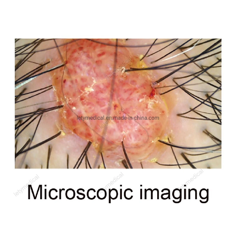 Dispositivo electrónico portátil Microscópio Dermatoscópio dermatoscópio de máquina de Teste de pele Analyzer Dermoscope Portátil