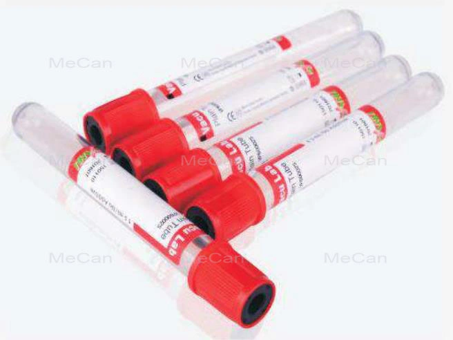 O vácuo de suprimentos médicos para tubos de ensaio de coleta de sangue SST