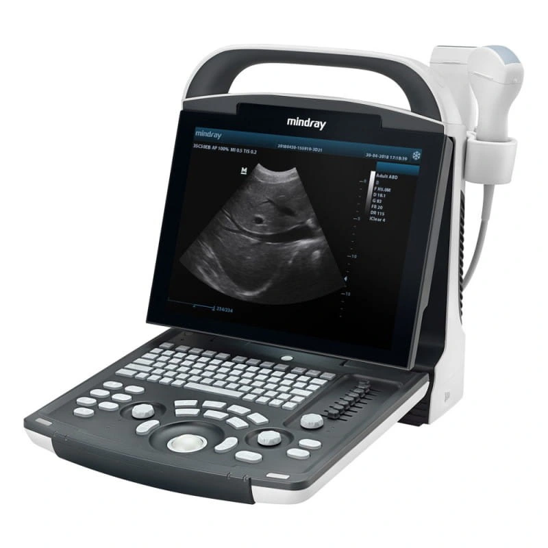 Mindray Dp-30 Power Edition Portable Ultrasound Machine