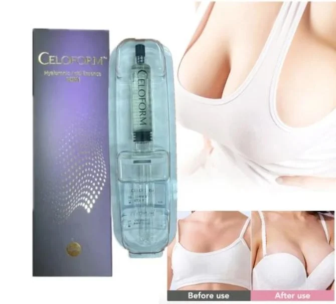 Celoform10ml Plastic Surgery Implants for Breast Buttock Enhance Large Size More Natural Safe Dermal Filler Hyaluronic Acid Gel Beads Max Breast Injection Price