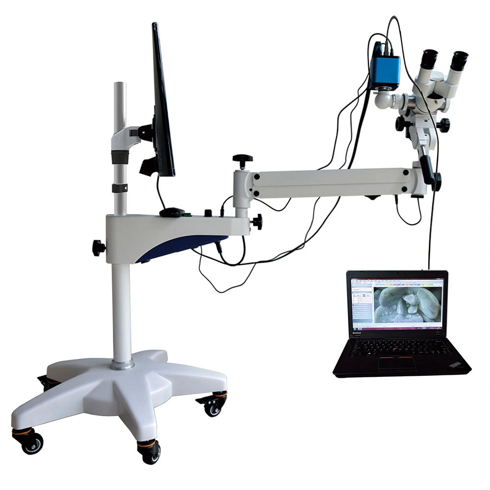 High Resolution Camera Video Vaginal Operation Microscope with 10W LED Lamp