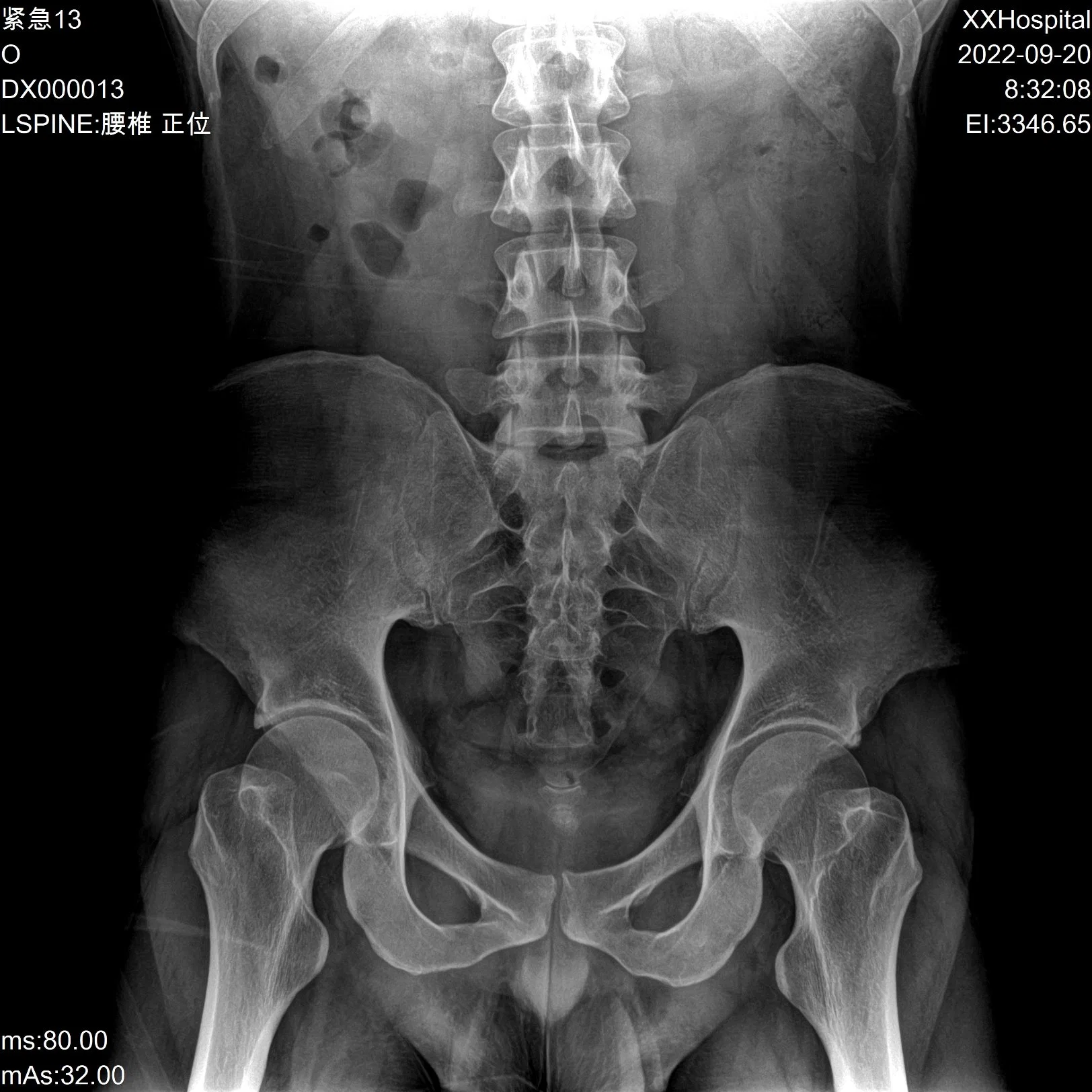 Sistema de radiografía digital China Rd-850X