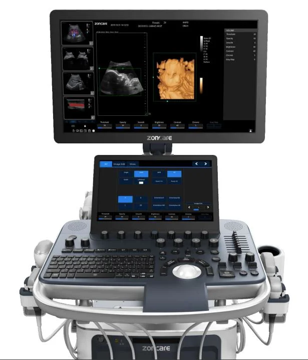 Color Doppler 3D/4D Ultrasound Scanner Pl-6018t